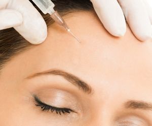 העלמת קמטי הבעה